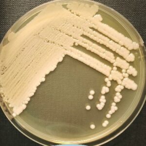 <em>Vishniacozyma carnescens</em> IST1010