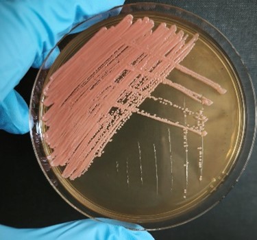 <em>Rhodotorula mucilaginosa</em> IST637