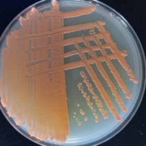 <em>Sporobolomyces roseus</em> IST724