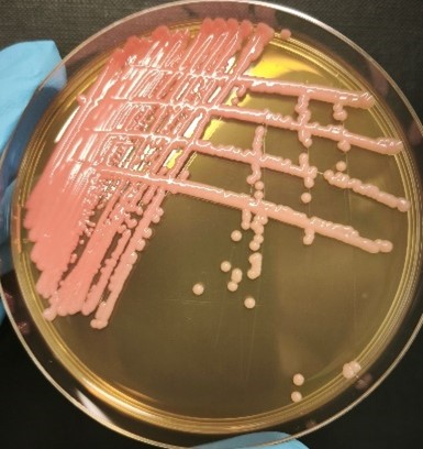 <em>Rhodotorula mucilaginosa</em> IST737