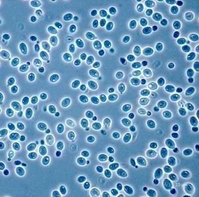 <em>Rhodotorula sphaerocarpa</em> IST816 - Image 2