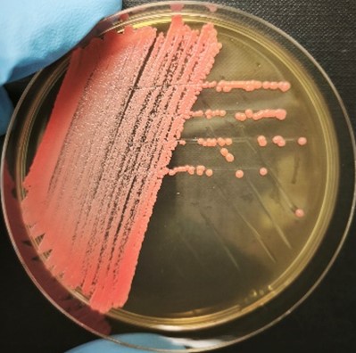 <em>Rhodotorula sphaerocarpa</em> IST816