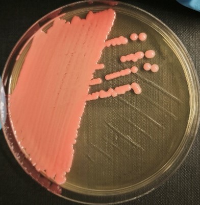 <em>Rhodotorula mucilaginosa</em> IST852