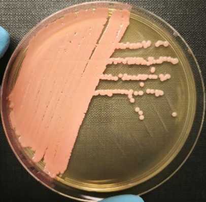 <em>Rhodotorula mucilaginosa</em> IST879