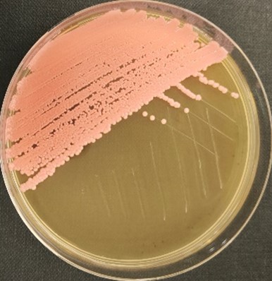 <em>Rhodotorula mucilaginosa</em> IST890