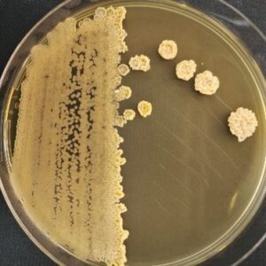 <em>Moesziomyces aphidis</em> IST923