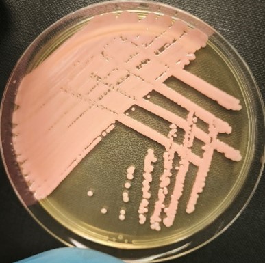 <em>Rhodotorula mucilaginosa</em> IST937