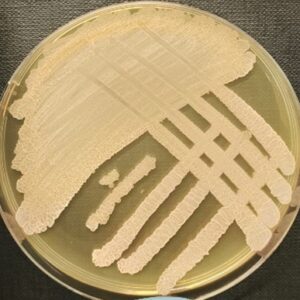 <em>Moesziomyces aphidis</em> IST946