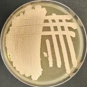 <em>Moesziomyces aphidis</em> IST987