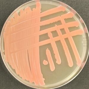 <em>Cystobasidium slooffiae</em> IST999